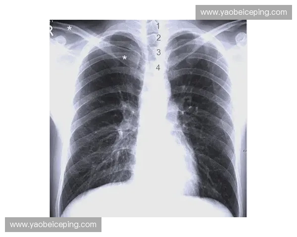 肋部渗透诊疗与影像学评估策略研究探索